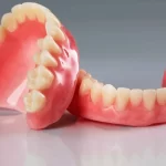 پروتز متحرک چیست